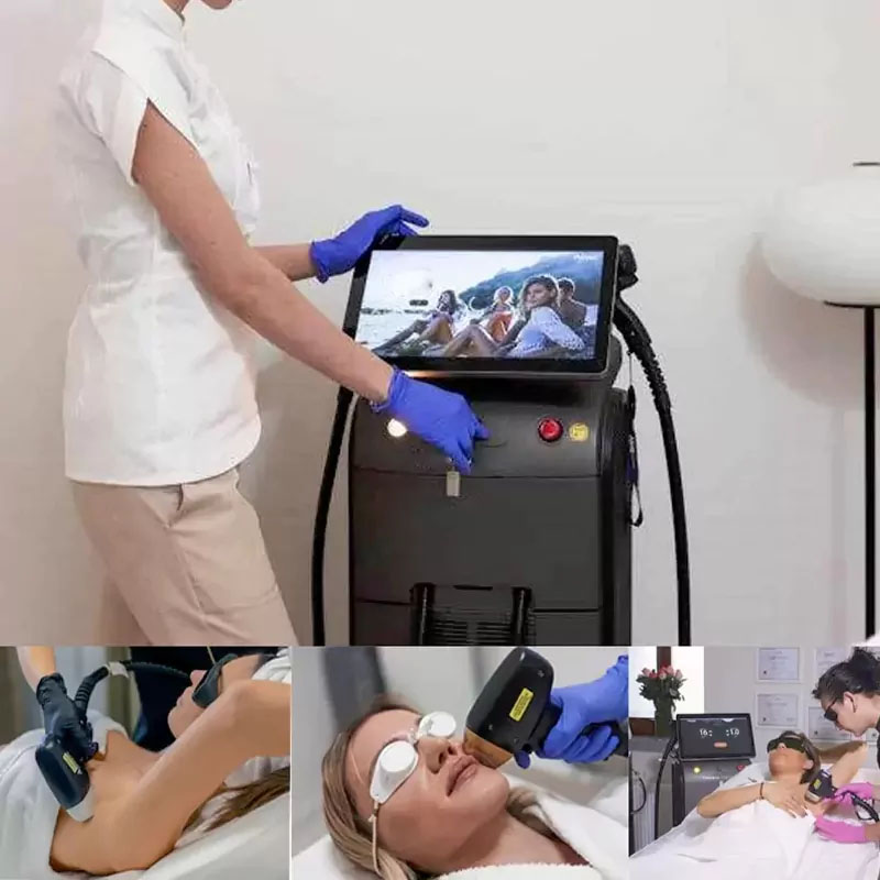 Diode-Laser-Hair-Removal-FAQ