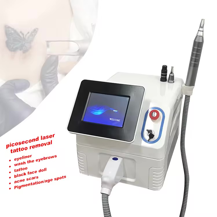 Laser tattoo removal g
