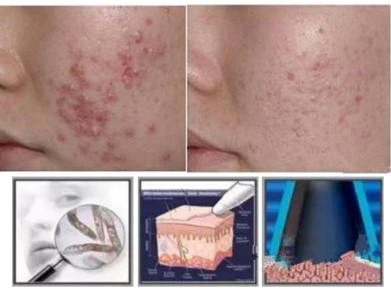 Understanding Non-Invasive Aesthetic Treatments and Their Benefits