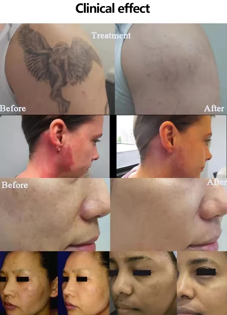 H72ed0acb849a4856a5cc17af324f3491f