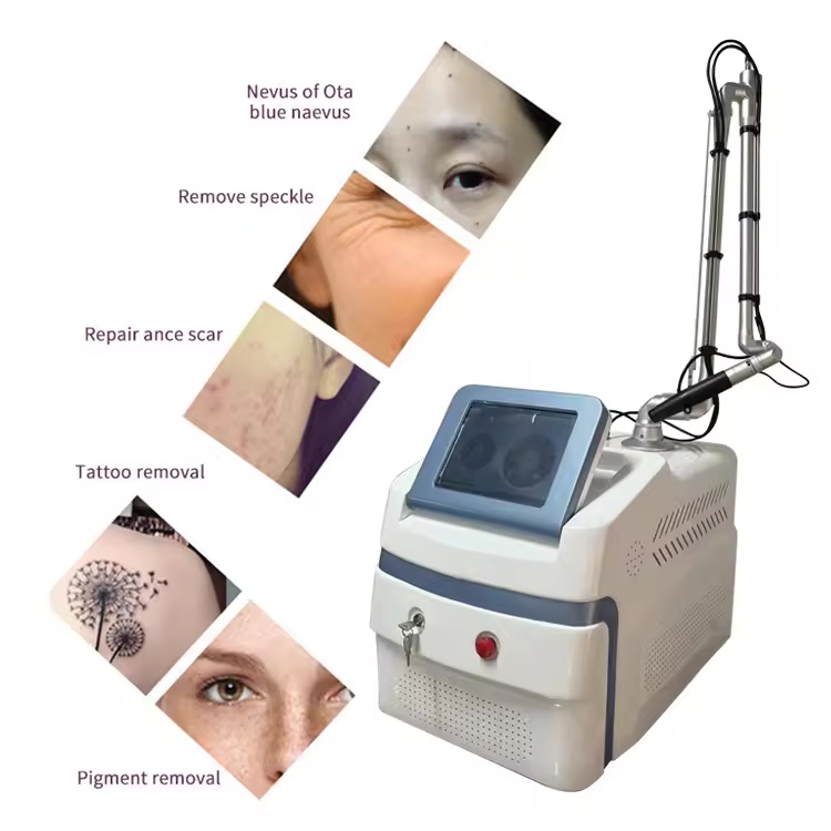 Laser Tattoo Removal