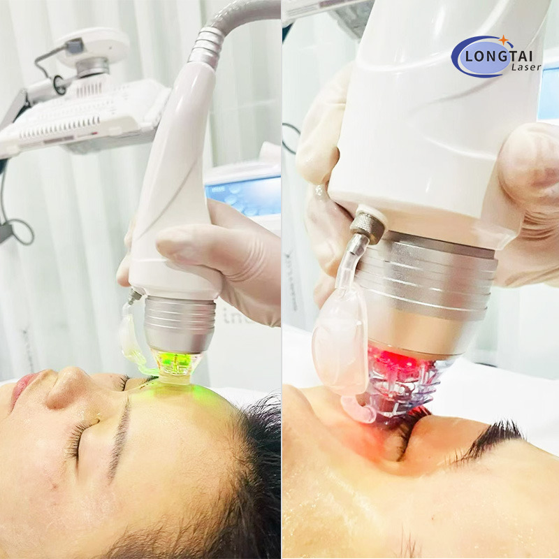 INUS Vacuum Fractional Micro Needle RF – For Wrinkles, Acne Scars, Lifting & Pores