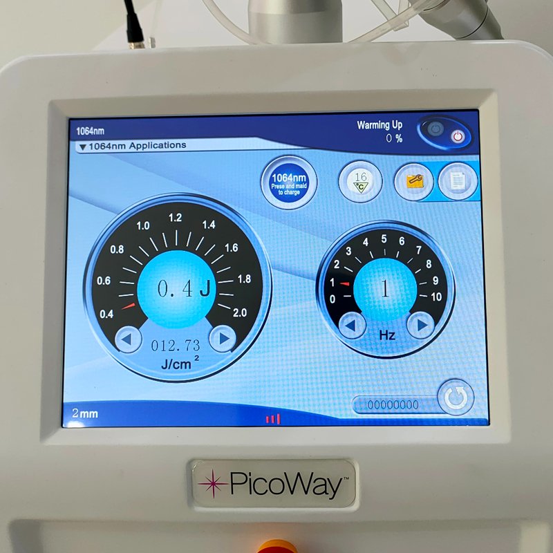 Laser Tattoo Removal