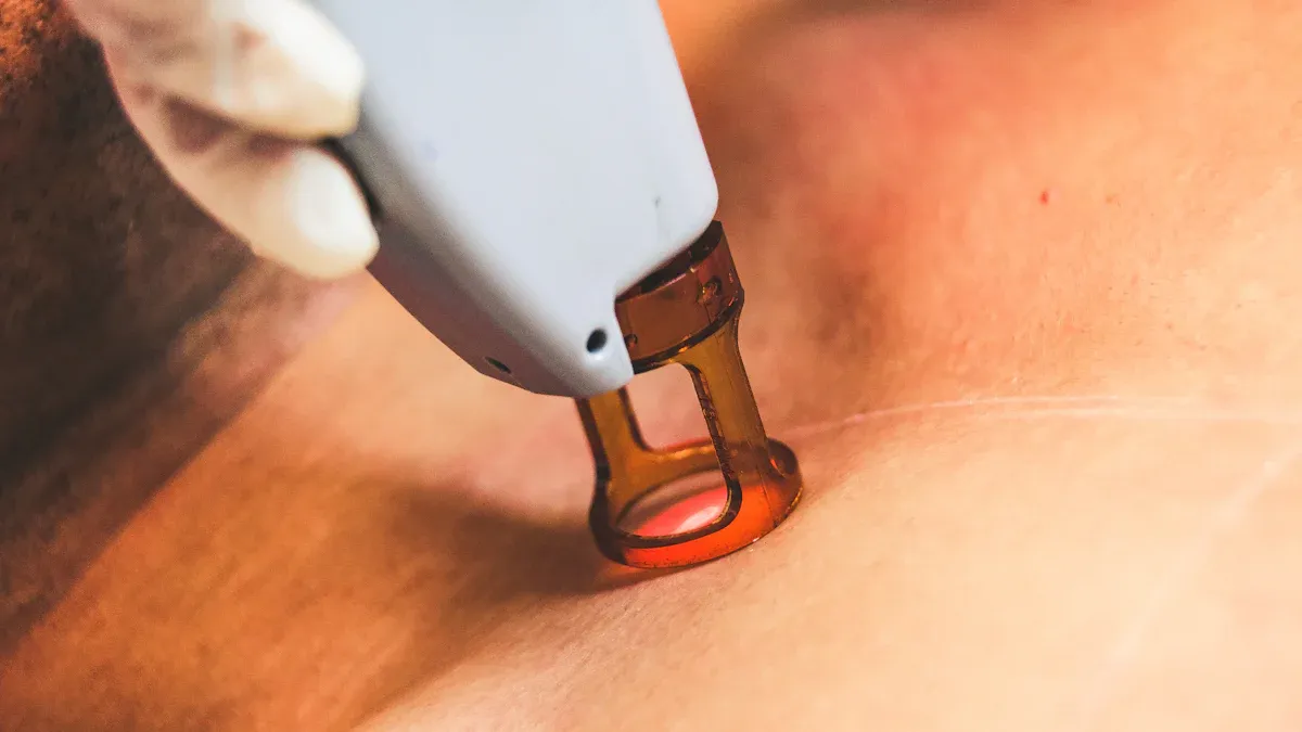 What Are the Different Types of Laser Treatments for Skin