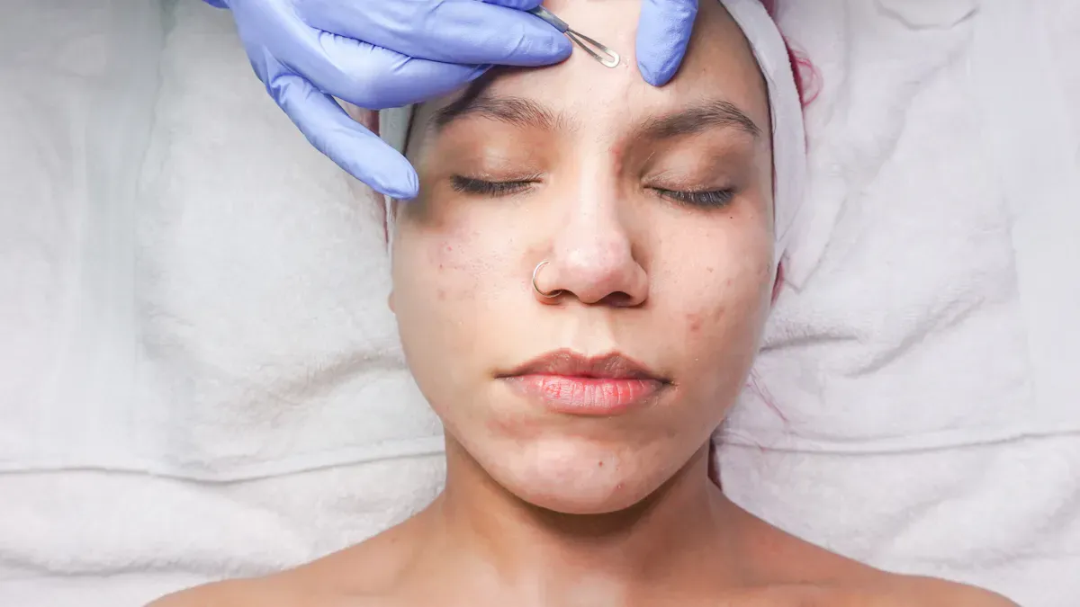Laser Skin Treatments for Common Concerns